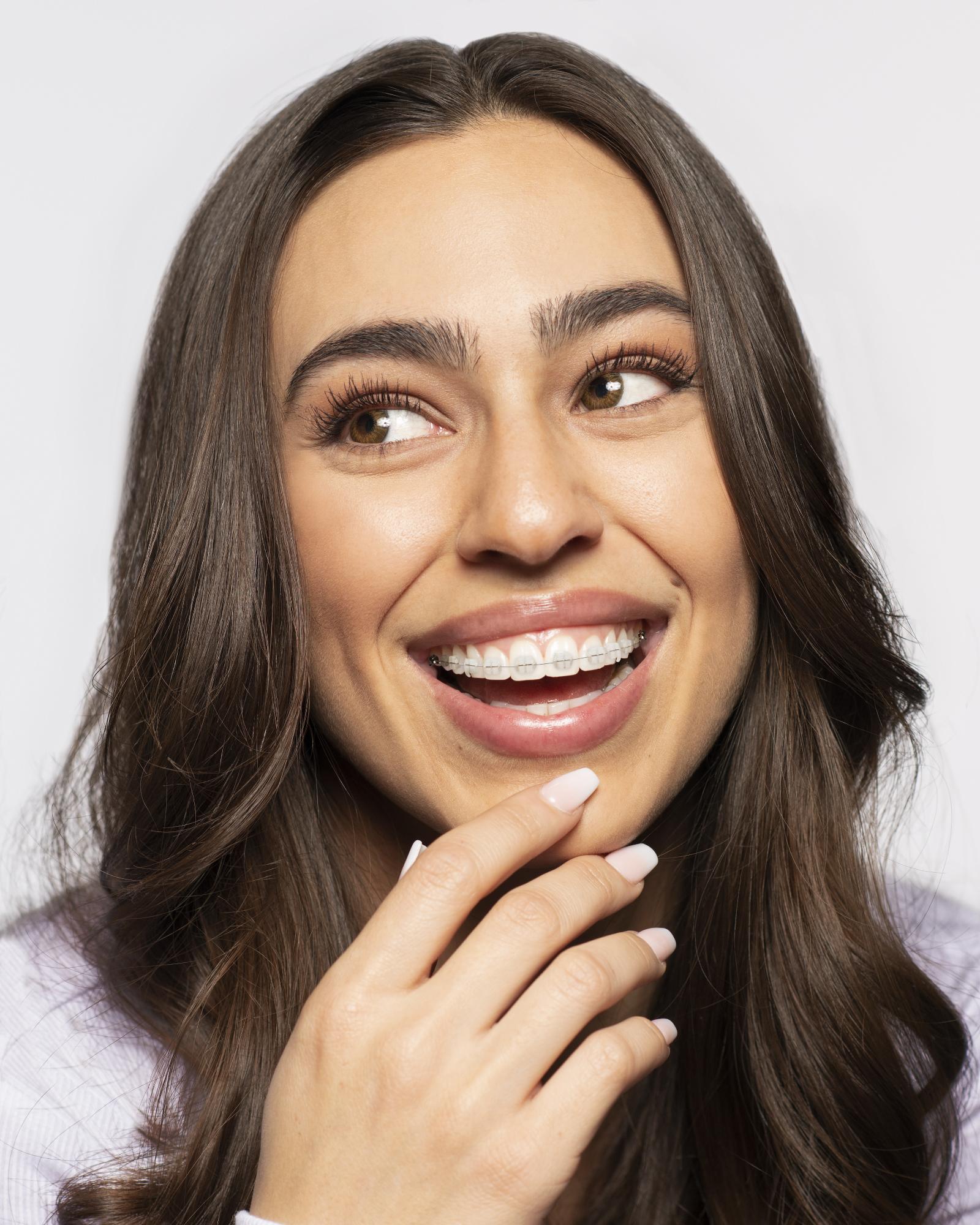 braces sammamish