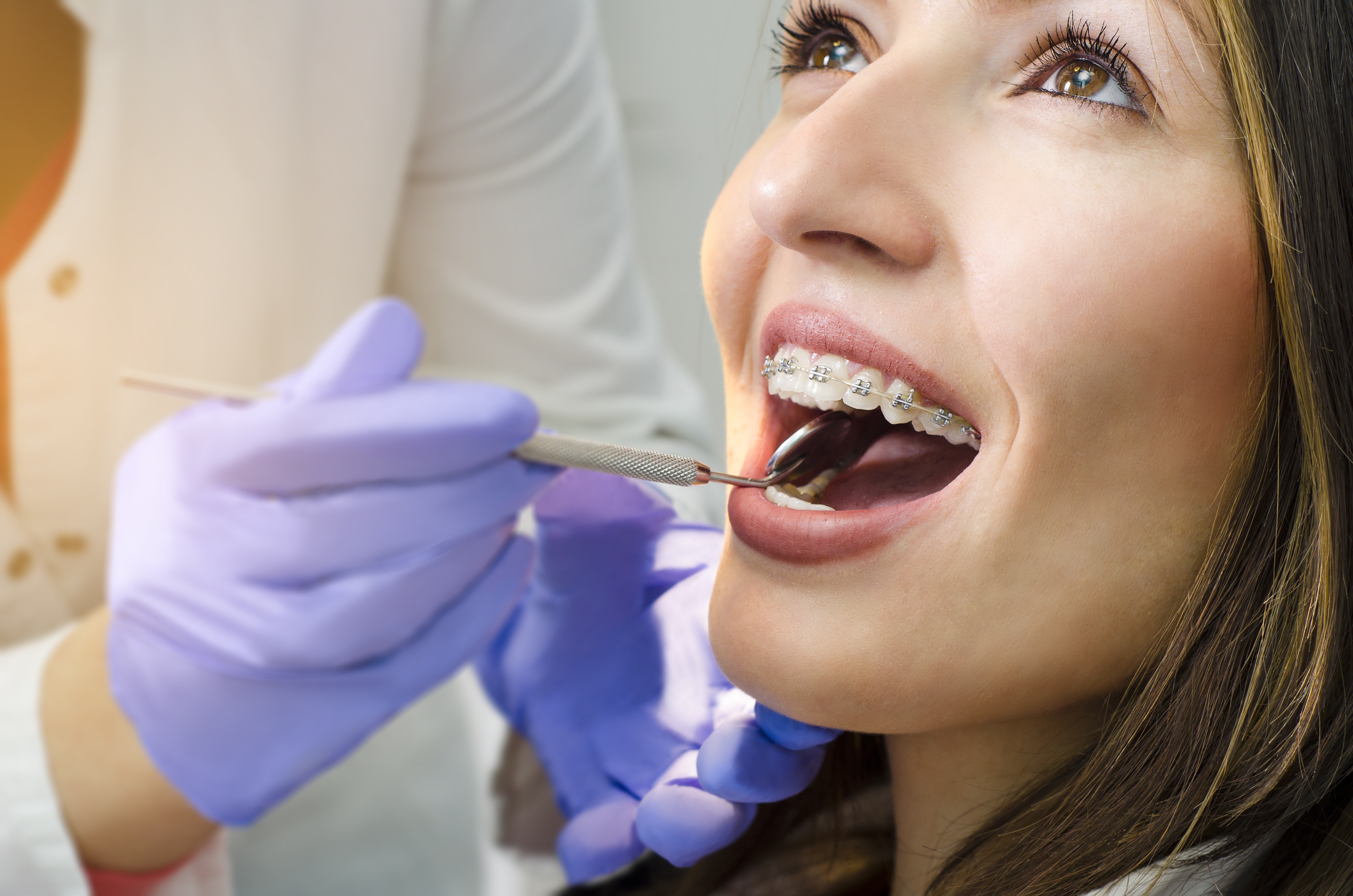 Closeup of smiling girl on dental braces check up