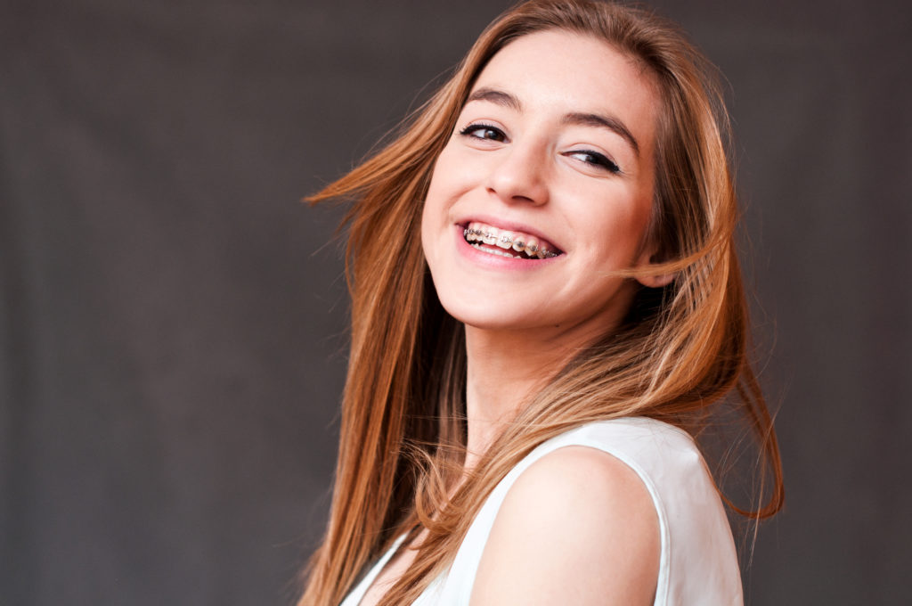 Braces Colours: How to Choose the Best Braces Colour for Your Teeth