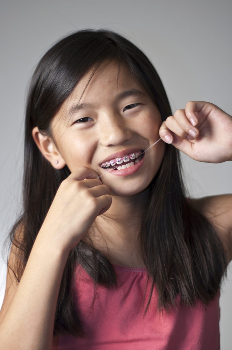 How To Floss With Braces Issaquah Braces Dudley Smiles