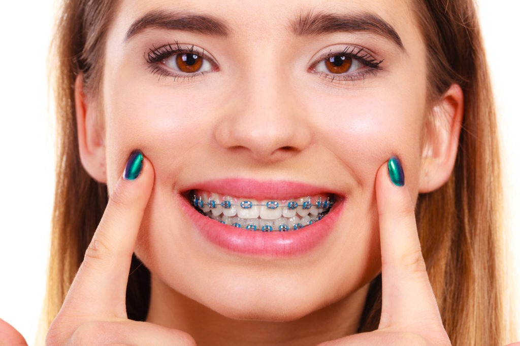 What role do elastics (rubber bands) play in orthodontics? - Dr