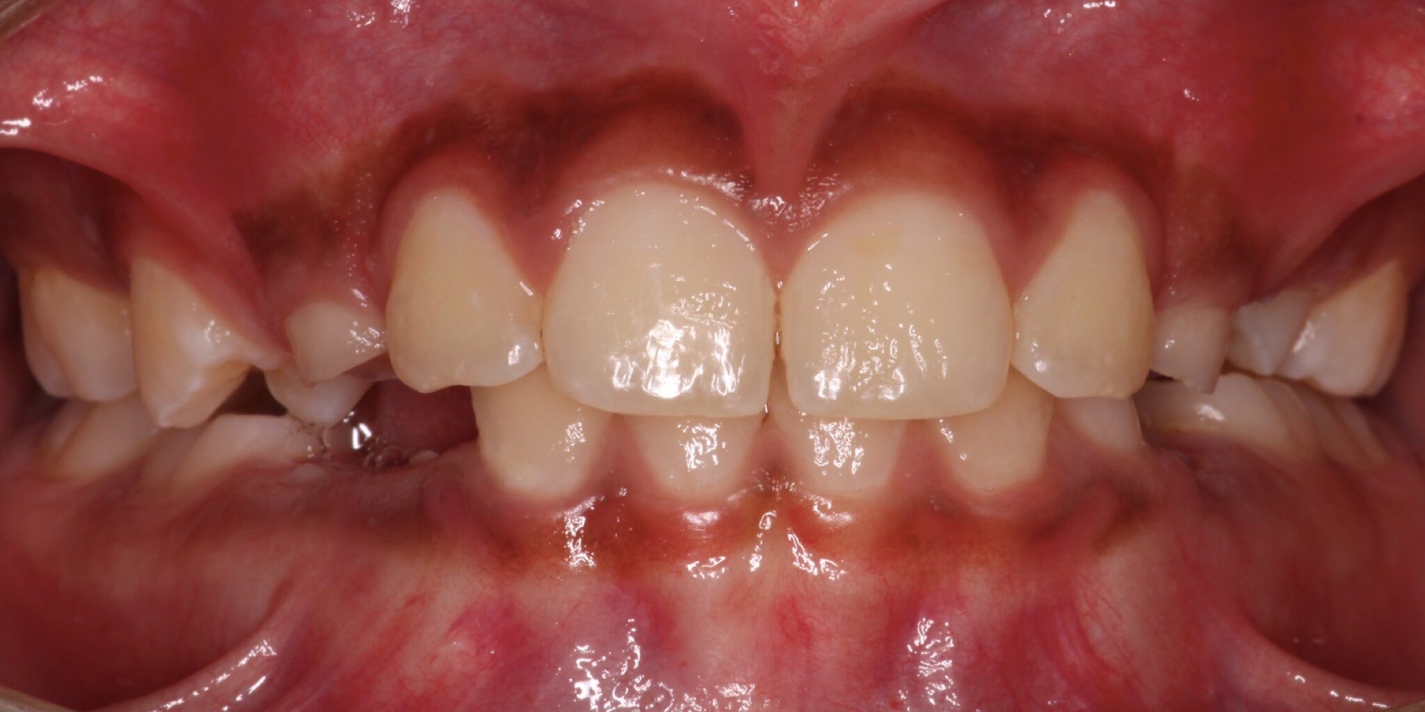 issaquah orthodontics